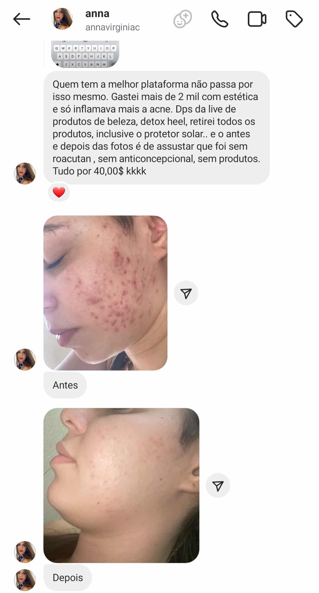 Depoimento — Hormônios · TPM